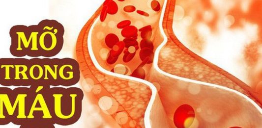 Mỡ máu cao và những điều cần biết về bệnh lý này