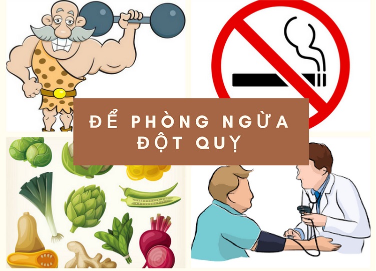 Tìm hiểu về các bệnh lý gây đột quỵ và cách phòng bệnh từ sớm