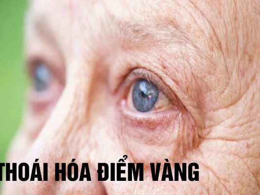 Ai có thể bị thoái hóa điểm vàng và cách phòng bệnh