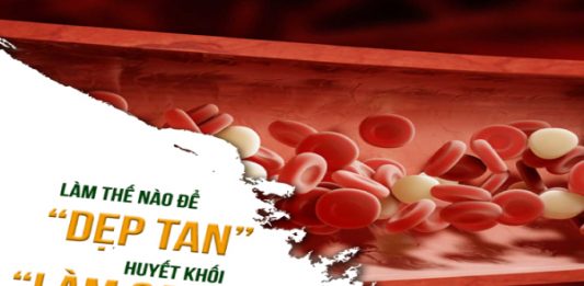 Điều trị và phòng huyết khối thế nào hiệu quả?